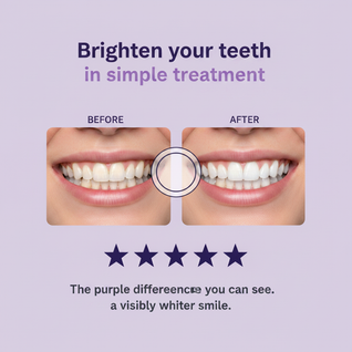 Teeth Whitening Strips