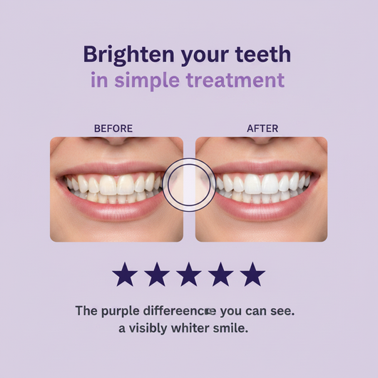 Teeth Whitening Strips